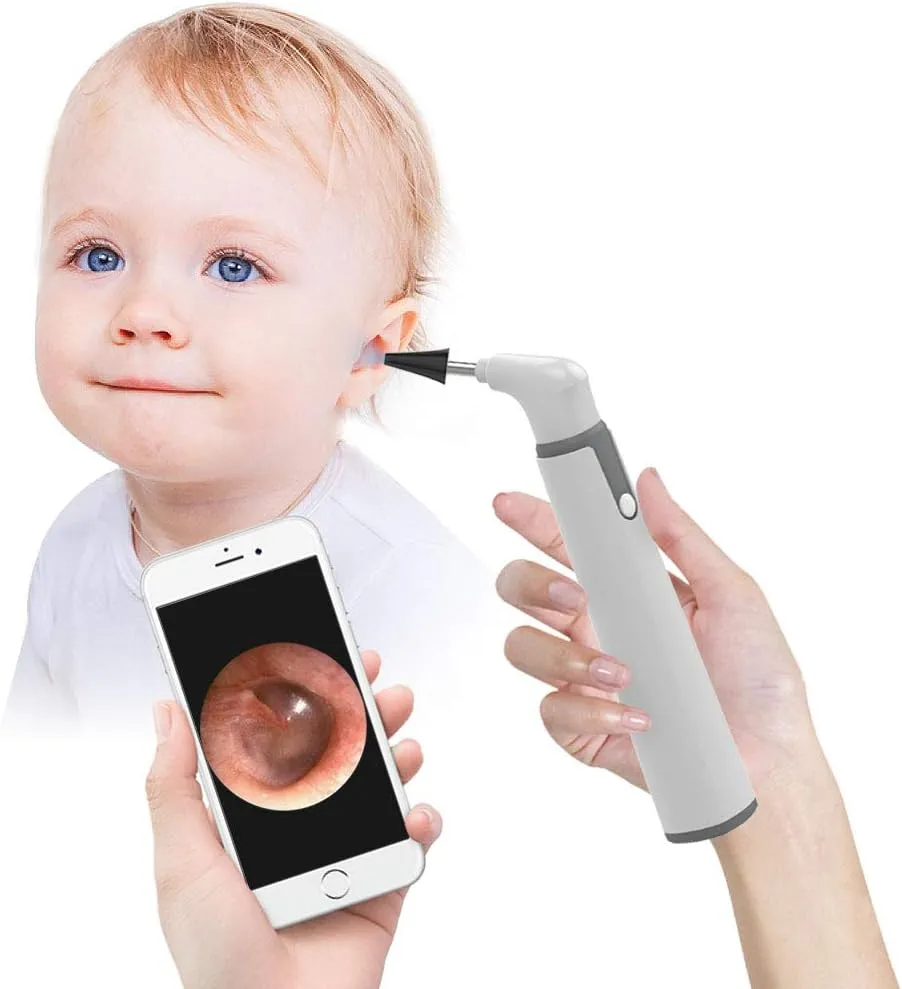 Wireless Otoscope, Ear Scope with 720P HD Ear Camera and 6 LED Lights, Ear Wax Removal Tool Camera with Gyroscope, Digital Otoscope with Light, Compatible with iPhone and Android